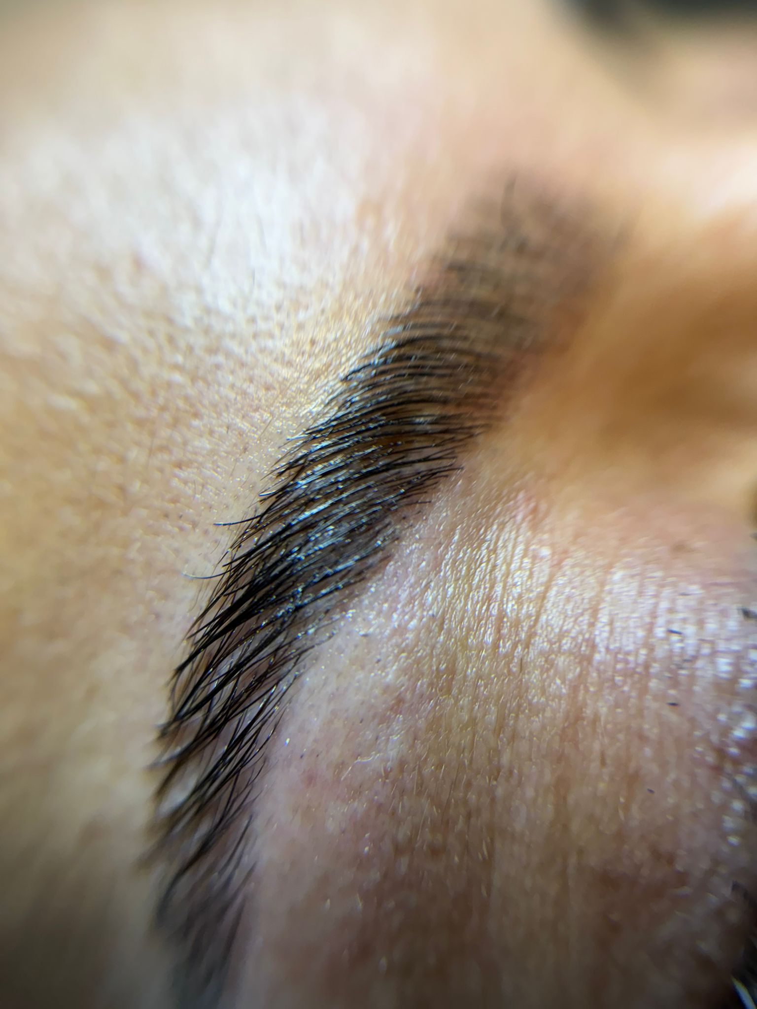 R&eacute;sultat browlift sourcils