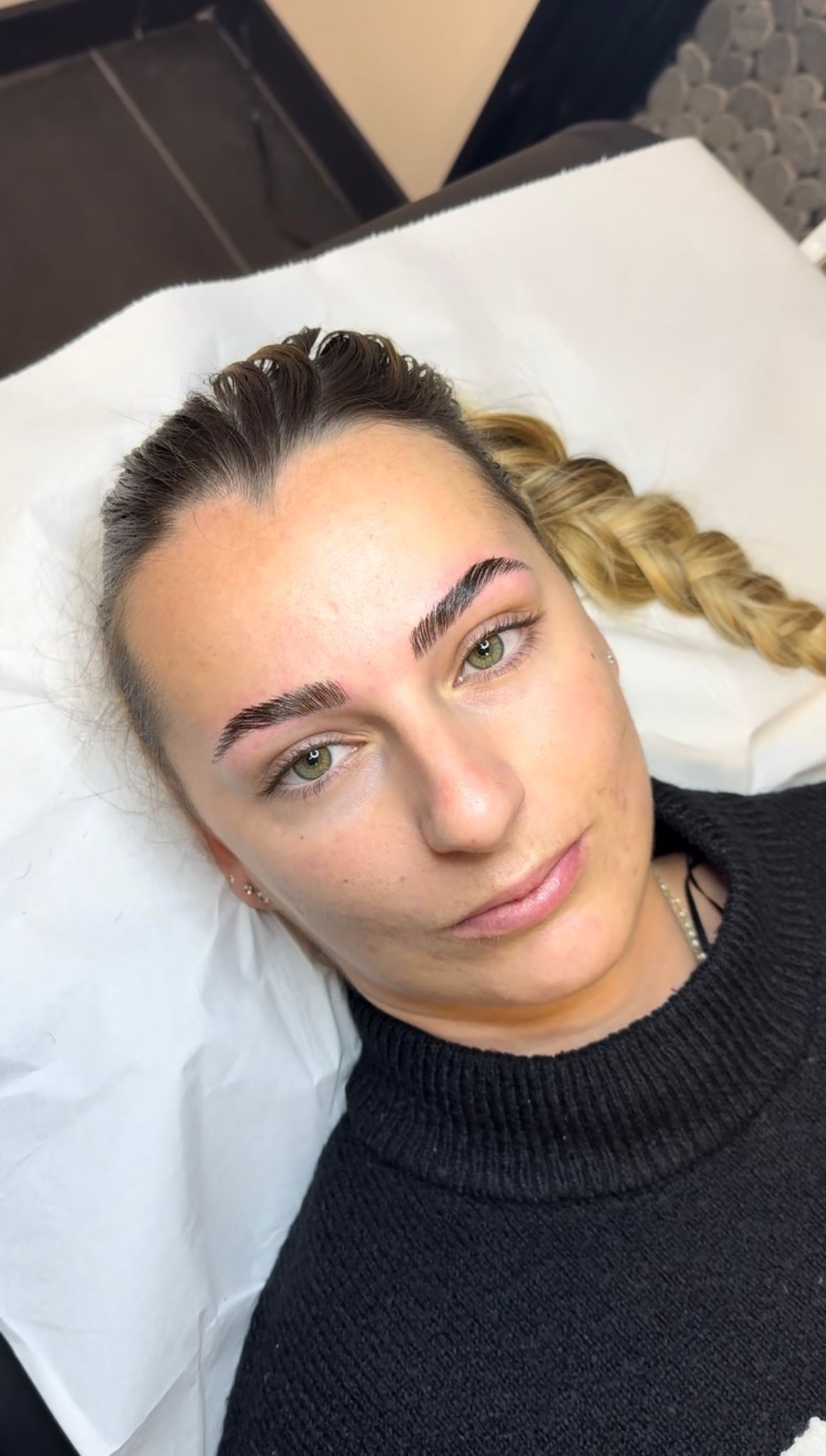 Browlift cliente, r&eacute;sultat naturel